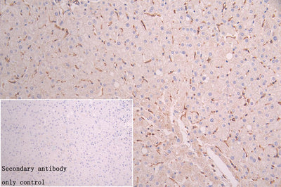 Immunohistochemistry of paraffin-embedded human tonsil tissue using FBXO22 Antibody at dilution of 1:100Rabbit anti-Human FBXO22 Polyclonal Antibody