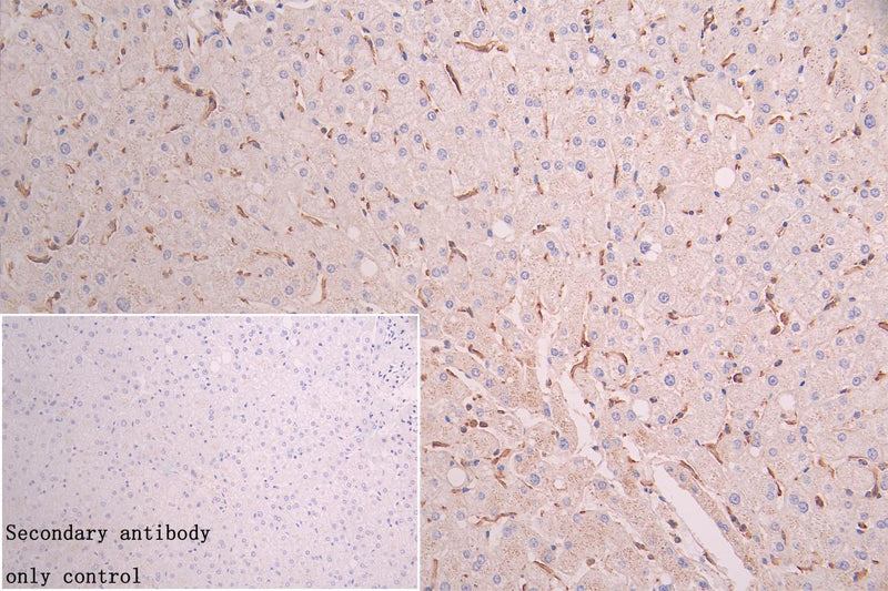 Immunohistochemistry of paraffin-embedded human tonsil tissue using FBXO22 Antibody at dilution of 1:100Rabbit anti-Human FBXO22 Polyclonal Antibody