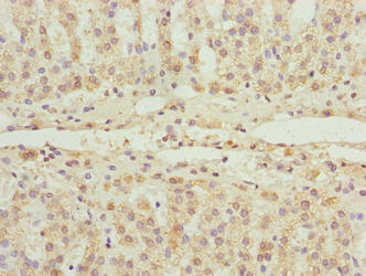 Immunohistochemistry of paraffin-embedded human adrenal gland tissue using FLAD1 Antibody at dilution of 1:100Rabbit anti-Human FLAD1 Polyclonal Antibody