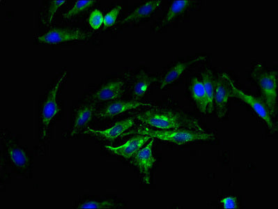 Immunofluorescence staining of Hela cells with SGMS2 Antibody at 1:200, counter-stained with DAPI. The cells were fixed in 4% formaldehyde, permeabilized using 0.2% Triton X-100 and blocked in 10% normal Goat Serum. The cells were then incubated with the antibody overnight at 4°C. The secondary antibody was Alexa Fluor 488-congugated AffiniPure Goat Anti-Rabbit IgG(H+L).Rabbit anti-Human SGMS2 Polyclonal Antibody