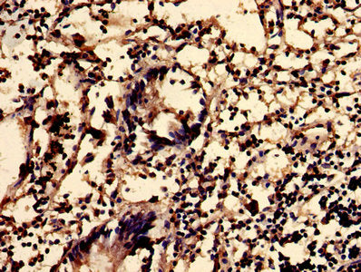 IHC image of SGMS2 Antibody diluted at 1:600 and staining in paraffin-embedded human appendix tissue performed on a Leica BondTM system. After dewaxing and hydration, antigen retrieval was mediated by high pressure in a citrate buffer (pH 6.0). Section was blocked with 10% normal goat serum 30min at RT. Then primary antibody (1% BSA) was incubated at 4°C overnight. The primary is detected by a biotinylated secondary antibody and visualized using an HRP conjugated SP system.Rabbit anti-Human SGMS2 Polyclonal Antibody