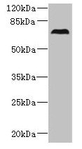 Western blot  | All lanes: CEP76 antibody at 0.5µg/ml + 293T whole cell lysate  | Secondary  | Goat polyclonal to rabbit IgG at 1/10000 dilution  | Predicted band size: 75, 66, 30 kDa  | Observed band size: 75 kDaRabbit anti-Human CEP76 Polyclonal Antibody