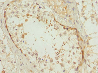 Immunohistochemistry of paraffin-embedded human testis tissue using POC1B Antibody at dilution of 1:100Rabbit anti-Human POC1B Polyclonal Antibody