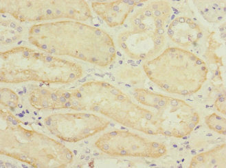 Immunohistochemistry of paraffin-embedded human kidney tissue using SLC22A8 Antibody at dilution of 1:100Rabbit anti-Human SLC22A8 Polyclonal Antibody