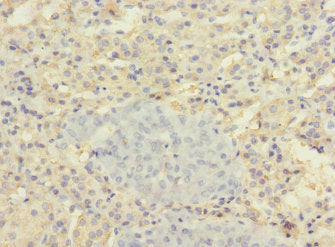 Immunohistochemistry of paraffin-embedded human adrenal gland tissue using SLC22A8 Antibody at dilution of 1:100Rabbit anti-Human SLC22A8 Polyclonal Antibody