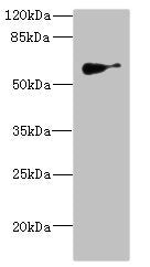 Western blot | All lanes: SLC22A8antibody IgG at 1.62μg/ml + Mouse kidney tissue | Secondary | Goat polyclonal to rabbit IgG at 1/10000 dilution | Predicted band size: 60, 61, 47, 12, 50 kDa | Observed band size: 60 kDaRabbit anti-Human SLC22A8 Polyclonal Antibody