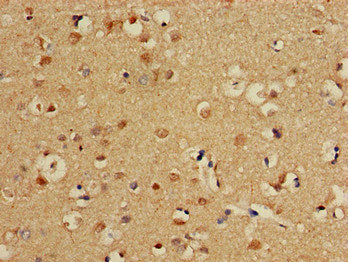 Immunohistochemistry of paraffin-embedded human brain tissue using CPT1C Antibody at dilution of 1:100Rabbit anti-Human CPT1C Polyclonal Antibody
