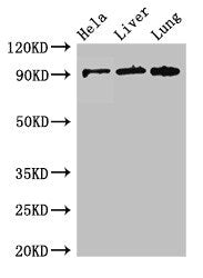 Western Blot  | Positive WB detected in: Hela whole cell lysate, Mouse liver tissue, Mouse lung tissue  | All lanes: CPT1C antibody at 2.6µg/ml  | Secondary  | Goat polyclonal to rabbit IgG at 1/50000 dilution  | Predicted band size: 91, 90, 81 kDa  | Observed band size: 91 kDaRabbit anti-Human CPT1C Polyclonal Antibody