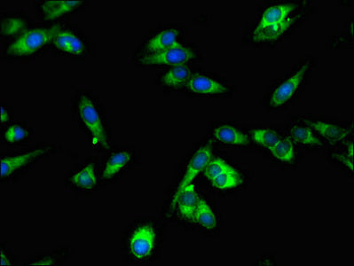Immunofluorescent analysis of Hela cells using SPPL2A Antibody at dilution of 1:100 and Alexa Fluor 488-congugated AffiniPure Goat Anti-Rabbit IgG(H+L)Rabbit anti-Human SPPL2A Polyclonal Antibody