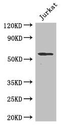 Western Blot  | Positive WB detected in: Jurkat whole cell lysate  | All lanes: SPPL2A antibody at 2µg/ml  | Secondary  | Goat polyclonal to rabbit IgG at 1/50000 dilution  | Predicted band size: 59 kDa  | Observed band size: 59 kDaRabbit anti-Human SPPL2A Polyclonal Antibody