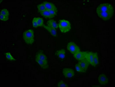 Immunofluorescence staining of HepG2 cells with RAET1E Antibody at 1:200, counter-stained with DAPI. The cells were fixed in 4% formaldehyde, permeabilized tissue using 0.2% Triton X-100 and blocked in 10% normal Goat Serum. The cells were then incubated with the antibody overnight at 4°C.The secondary antibody was Alexa Fluor 488-congugated AffiniPure Goat Anti-Rabbit IgG (H+L).Rabbit anti-Human RAET1E Polyclonal Antibody