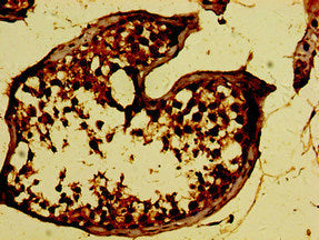 Immunohistochemistry of paraffin-embedded human testis tissue using the antibody at dilution of 1:100Rabbit anti-Human RAET1E Polyclonal Antibody