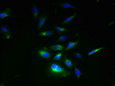 Immunofluorescent analysis of Hela cells using RNF133 Antibody at dilution of 1:100 and Alexa Fluor 488-congugated AffiniPure Goat Anti-Rabbit IgG(H+L)Rabbit anti-Human RNF133 Polyclonal Antibody