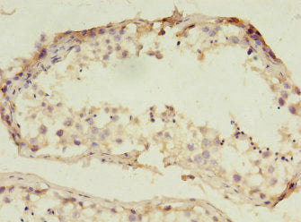 Immunohistochemistry of paraffin-embedded human testis tissue using RNF133 Antibody at dilution of 1:100Rabbit anti-Human RNF133 Polyclonal Antibody