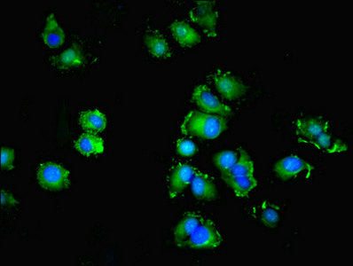 Immunofluorescent analysis of MCF-7 cells using SPIRE2 Antibody at dilution of 1:100 and Alexa Fluor 488-congugated AffiniPure Goat Anti-Rabbit IgG(H+L)Rabbit anti-Human SPIRE2 Polyclonal Antibody