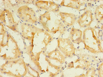 Immunohistochemistry of paraffin-embedded human kidney tissue using the antibody at dilution of 1:100Rabbit anti-Human SPIRE2 Polyclonal Antibody
