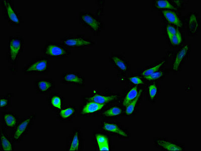 Immunofluorescent analysis of Hela cells using DNAAF4 Antibody at dilution of 1:100 and Alexa Fluor 488-congugated AffiniPure Goat Anti-Rabbit IgG(H+L)Rabbit anti-Human DNAAF4 Polyclonal Antibody
