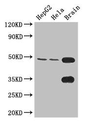 Western Blot  | Positive WB detected in: HepG2 whole cell lysate, Hela whole cell lysate, Mouse brain tissue  | All lanes: DNAAF4 antibody at 3.4µg/ml  | Secondary  | Goat polyclonal to rabbit IgG at 1/50000 dilution  | Predicted band size: 49, 45 kDa  | Observed band size: 49 kDaRabbit anti-Human DNAAF4 Polyclonal Antibody