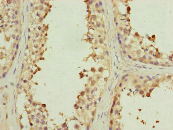 Immunohistochemistry of paraffin-embedded human testis tissue using MYLIP Antibody at dilution of 1:100Rabbit anti-Human MYLIP Polyclonal Antibody
