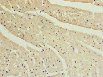 Immunohistochemistry of paraffin-embedded human heart tissue using MYLIP Antibody at dilution of 1:100Rabbit anti-Human MYLIP Polyclonal Antibody