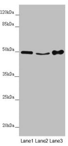 Western blot | All lanes: MYLIP antibody at 4.06 μg/ml | Lane 1: Mouse brain tissue | Lane 2: Mouse liver tissue | Lane 3: Mouse spleen tissue | Secondary | Goat polyclonal to rabbit IgG at 1/10000 dilution | Predicted band size: 50, 15 kDa | Observed band size: 50 kDaRabbit anti-Human MYLIP Polyclonal Antibody