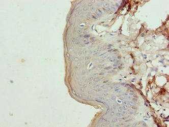 Immunohistochemistry of paraffin-embedded human skin tissue using KRT35 Antibody at dilution of 1:100
