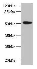 Western blot  | All lanes: KRT35 antibody at 4µg/ml + PC-3 whole cell lysate  | Secondary  | Goat polyclonal to rabbit IgG at 1/10000 dilution  | Predicted band size: 51 kDa  | Observed band size: 51 kDa