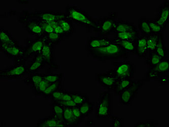 Immunofluorescence staining of Hela cells with TAF15 Antibody at 1:100, counter-stained with DAPI. The cells were fixed in 4% formaldehyde, permeabilized using 0.2% Triton X-100 and blocked in 10% normal Goat Serum. The cells were then incubated with the antibody overnight at 4°C. The secondary antibody was Alexa Fluor 488-congugated AffiniPure Goat Anti-Rabbit IgG(H+L).Rabbit anti-Human TAF15 Polyclonal Antibody