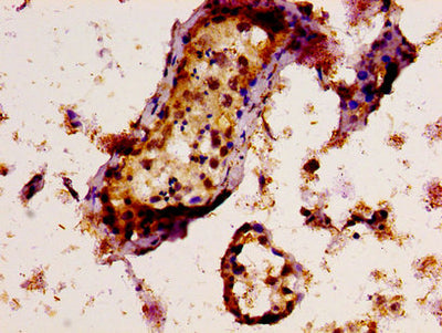 IHC image of TAF15 Antibody diluted at 1:300 and staining in paraffin-embedded human testis tissue performed on a Leica BondTM system. After dewaxing and hydration, antigen retrieval was mediated by high pressure in a citrate buffer (pH 6.0). Section was blocked with 10% normal goat serum 30min at RT. Then primary antibody (1% BSA) was incubated at 4°C overnight. The primary is detected by a biotinylated secondary antibody and visualized using an HRP conjugated SP system.Rabbit anti-Human TAF15 Polyclonal Antibody