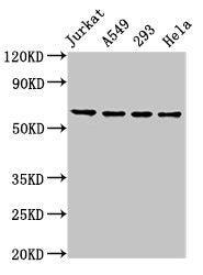 Western Blot | Positive WB detected in: Jurkat whole cell lysate, A549 whole cell lysate, 293 whole cell lysate, Hela whole cell lysate | All lanes: TAF15 antibody at 8.5μg/ml | Secondary | Goat polyclonal to rabbit IgG at 1/50000 dilution | Predicted band size: 62 kDa | Observed band size: 62 kDaRabbit anti-Human TAF15 Polyclonal Antibody