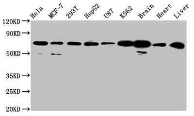 Western Blot  | Positive WB detected in: Hela whole cell lysate, MCF-7 whole cell lysate, 293T whole cell lysate, HepG2 whole cell lysate, U87 whole cell lysate, K562 whole cell lysate, Rat brain tissue, Mouse heart tissue, Mouse liver tissue  | All lanes: SLCO2A1 antibody at 2.7µg/ml  | Secondary  | Goat polyclonal to rabbit IgG at 1/50000 dilution  | Predicted band size: 71 kDa  | Observed band size: 71 kDaRabbit anti-Human SLCO2A1 Polyclonal Antibody