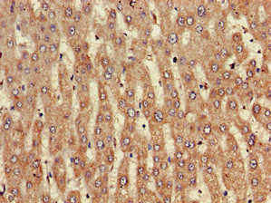 Immunohistochemistry of paraffin-embedded human liver tissue using the antibody at dilution of 1:100Rabbit anti-Human NINJ1 Polyclonal Antibody
