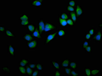 Immunofluorescence staining of Hela cells with USP9X Antibody at 1:100, counter-stained with DAPI. The cells were fixed in 4% formaldehyde, permeabilized using 0.2% Triton X-100 and blocked in 10% normal Goat Serum. The cells were then incubated with the antibody overnight at 4°C. The secondary antibody was Alexa Fluor 488-congugated AffiniPure Goat Anti-Rabbit IgG(H+L).Rabbit anti-Human USP9X Polyclonal Antibody