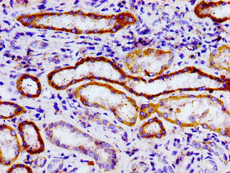 Immunohistochemistry of paraffin-embedded human kidney tissue using the antibody at dilution of 1:100Rabbit anti-Human USP9X Polyclonal Antibody