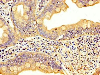 IHC image of LPP Antibody diluted at 1:300 and staining in paraffin-embedded human small intestine tissue performed on a Leica BondTM system. After dewaxing and hydration, antigen retrieval was mediated by high pressure in a citrate buffer (pH 6.0). Section was blocked with 10% normal goat serum 30min at RT. Then primary antibody (1% BSA) was incubated at 4°C overnight. The primary is detected by a biotinylated secondary antibody and visualized using an HRP conjugated SP system.