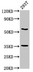 Western Blot | Positive WB detected in: 293T whole cell lysate | All lanes: LPP antibody at 7.5μg/ml | Secondary | Goat polyclonal to rabbit IgG at 1/50000 dilution | Predicted band size: 66 kDa | Observed band size: 66 kDa