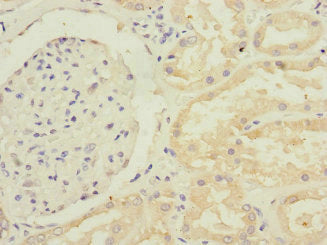 Immunohistochemistry of paraffin-embedded human kidney tissue using GFM2 Antibody at dilution of 1:100Rabbit anti-Human GFM2 Polyclonal Antibody