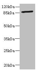 Western blot  | All lanes: GFM2 antibody at 3.24µg/ml + Jurkat whole cell lysate  | Secondary  | Goat polyclonal to rabbit IgG at 1/10000 dilution  | Predicted band size: 87, 82, 68, 58 kDa  | Observed band size: 87 kDaRabbit anti-Human GFM2 Polyclonal Antibody
