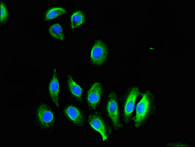Immunofluorescent analysis of A549 cells using CREB3L1 Antibody at dilution of 1:100 and Alexa Fluor 488-congugated AffiniPure Goat Anti-Rabbit IgG(H+L)Rabbit anti-Human CREB3L1 Polyclonal Antibody