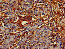 Immunohistochemistry of paraffin-embedded human pancreatic tissue using CREB3L1 Antibody at dilution of 1:100Rabbit anti-Human CREB3L1 Polyclonal Antibody