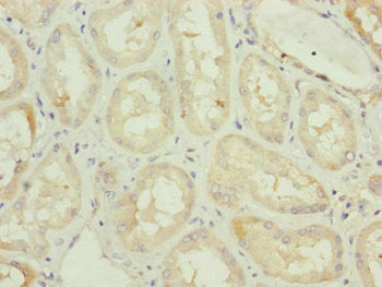 Immunohistochemistry of paraffin-embedded human kidney tissue using TAMM41 Antibody at dilution of 1:100Rabbit anti-Human TAMM41 Polyclonal Antibody