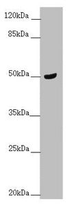 Western blot | All lanes: TAMM41 antibody at 1.68 μg/ml + Mouse brain tissue | Secondary | Goat polyclonal to rabbit IgG at 1/10000 dilution | Predicted band size: 52, 36, 39 kDa | Observed band size: 52 kDaRabbit anti-Human TAMM41 Polyclonal Antibody