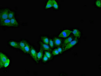 Immunofluorescent analysis of HepG2 cells using EFHD2 Antibody at dilution of 1:100 and Alexa Fluor 488-congugated AffiniPure Goat Anti-Rabbit IgG(H+L)Rabbit anti-Human EFHD2 Polyclonal Antibody