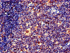 Immunohistochemistry of paraffin-embedded human tonsil tissue using EFHD2 Antibody at dilution of 1:100Rabbit anti-Human EFHD2 Polyclonal Antibody