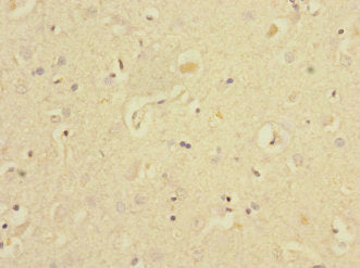 Immunohistochemistry of paraffin-embedded human brain tissue using EAF2 Antibody at dilution of 1:100Rabbit anti-Human EAF2 Polyclonal Antibody