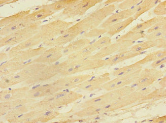 Immunohistochemistry of paraffin-embedded human heart tissue using EAF2 Antibody at dilution of 1:100Rabbit anti-Human EAF2 Polyclonal Antibody