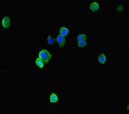 Immunofluorescence staining of HepG2 cells with EAF2 Antibody at 1:333, counter-stained with DAPI. The cells were fixed in 4% formaldehyde, permeabilized using 0.2% Triton X-100 and blocked in 10% normal Goat Serum. The cells were then incubated with the antibody overnight at 4°C. The secondary antibody was Alexa Fluor 488-congugated AffiniPure Goat Anti-Rabbit IgG(H+L).Rabbit anti-Human EAF2 Polyclonal Antibody
