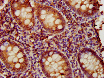 IHC image of EAF2 Antibody diluted at 1:1000 and staining in paraffin-embedded human appendix tissue performed on a Leica BondTM system. After dewaxing and hydration, antigen retrieval was mediated by high pressure in a citrate buffer (pH 6.0). Section was blocked with 10% normal goat serum 30min at RT. Then primary antibody (1% BSA) was incubated at 4°C overnight. The primary is detected by a biotinylated secondary antibody and visualized using an HRP conjugated SP system.Rabbit anti-Human EAF2 Polyclonal Antibody