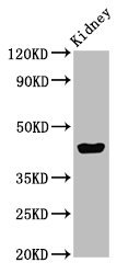 Western Blot | Positive WB detected in: Mouse kidney tissue | All lanes: EAF2 antibody at 3μg/ml | Secondary | Goat polyclonal to rabbit IgG at 1/50000 dilution | Predicted band size: 29, 15 kDa | Observed band size: 45 kDaRabbit anti-Human EAF2 Polyclonal Antibody