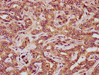 IHC image of RCN3 Antibody diluted at 1:200 and staining in paraffin-embedded human liver tissue performed on a Leica BondTM system. After dewaxing and hydration, antigen retrieval was mediated by high pressure in a citrate buffer (pH 6.0). Section was blocked with 10% normal goat serum 30min at RT. Then primary antibody (1% BSA) was incubated at 4°C overnight. The primary is detected by a biotinylated secondary antibody and visualized using an HRP conjugated SP system.Rabbit anti-Human RCN3 Polyclonal Antibody